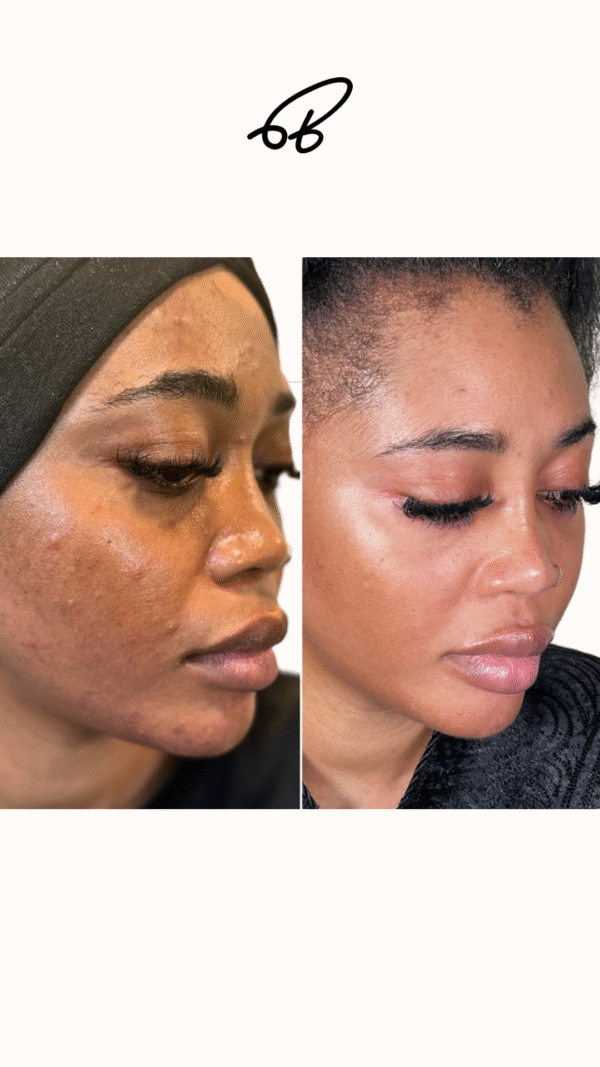 REJUVENATING GLOW FACIAL - Image 3